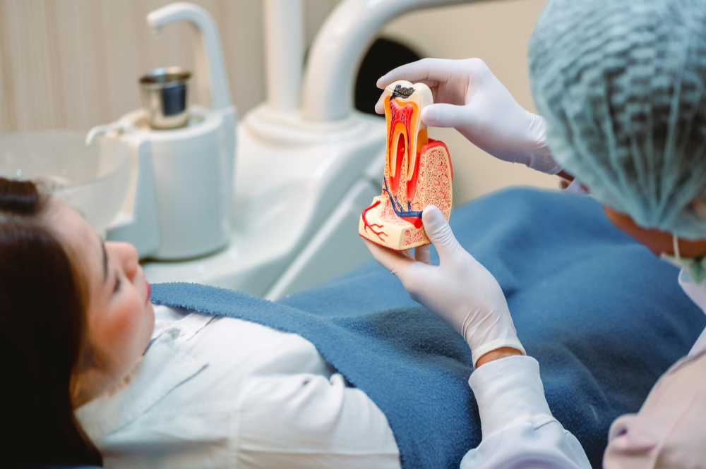 Root Canal